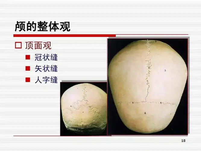 颅的整体观   顶面观   冠状缝   矢状缝   人字缝