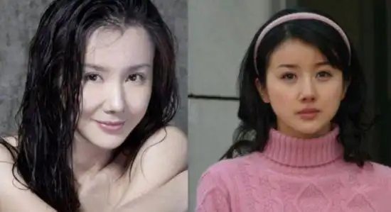 有着清纯相貌的孙菲菲,希望五官可以更大气,但整容效果却并不如意.