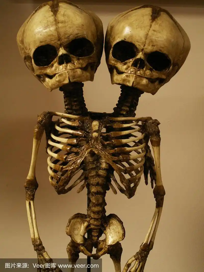人类骨架,连体人,垂直画幅,骨骼,胸腔