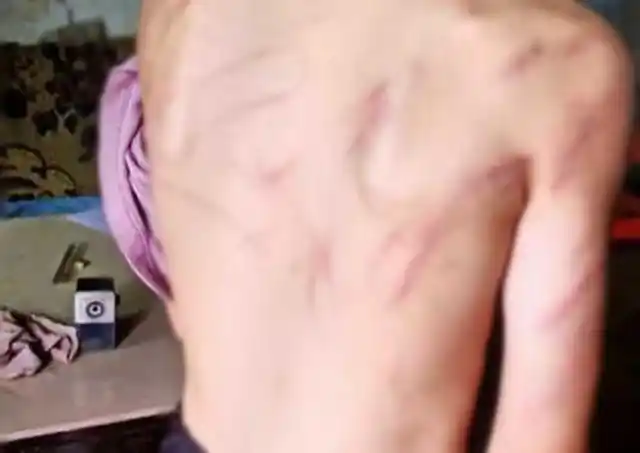 13岁男孩满身伤痕,继母称正常管教,暴力教育会毁了孩子一生