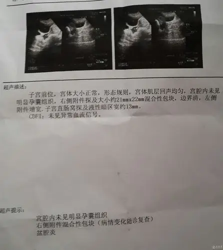 怀孕40天b超检测结果请大家看看本人万分焦急