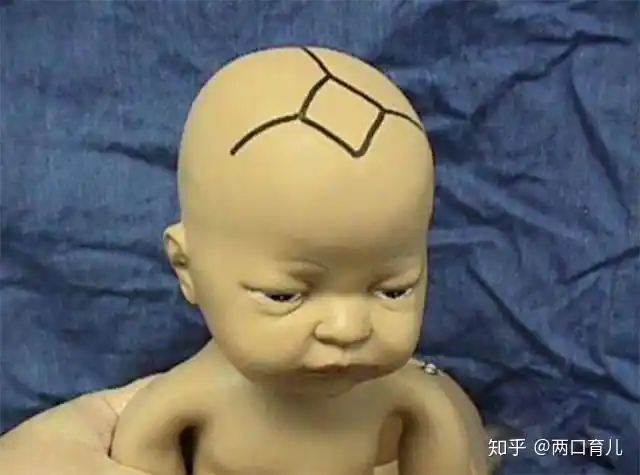 囟门闭合的时间对大脑发育有什么影响如果是第三种就该注意了