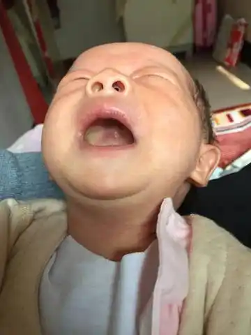 鹅口疮治疗方法