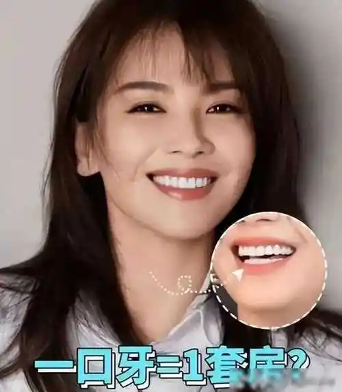 刘涛一口蓝牙上热搜,网传值300万,网友调侃:这牙能连接音响_文章_牙齿