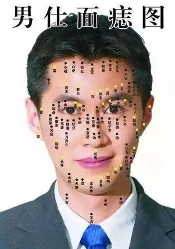 详解什么是克妻痣男人脸上有哪些痣克妻
