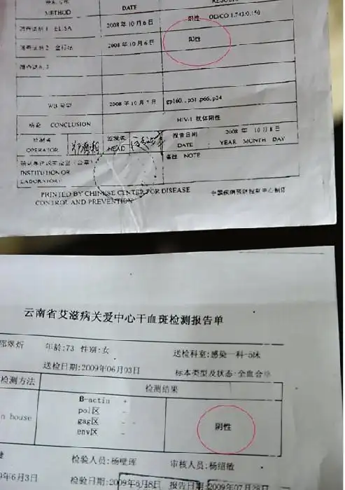 患上胸积水去省外医院看病 七旬大妈被误诊得了艾滋病