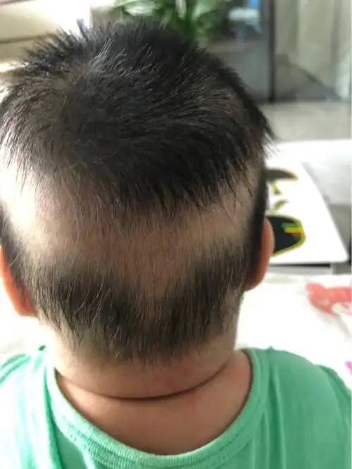 婴儿圆头_头型_枕头_宝宝头型_母婴_育儿经验