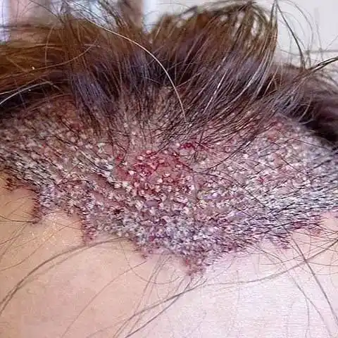 密集恐惧症不是病50张密恐图敢不敢接受挑战