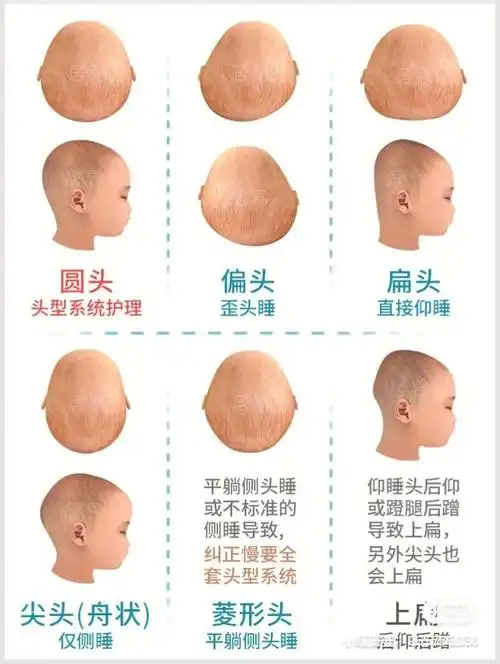 也出现了,现在宝宝越来越大,特别希望脚一直蹬,以至于现在头型上扁了