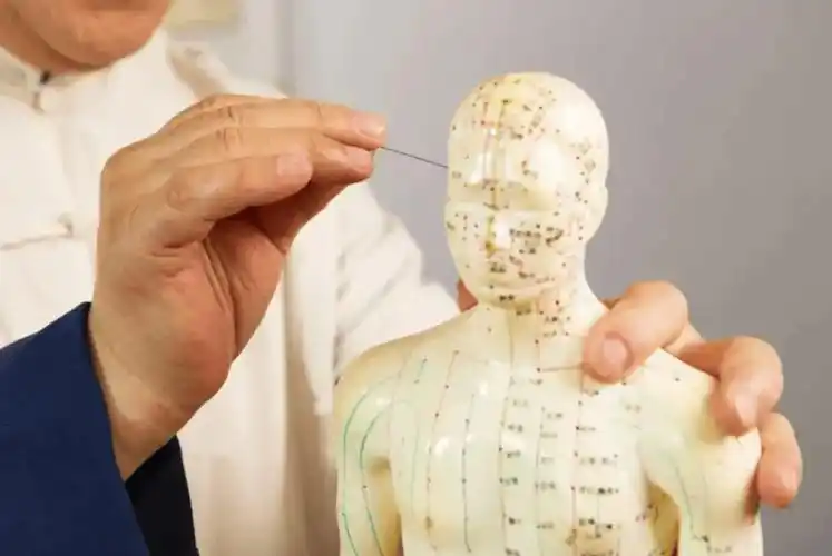 【医文医话】针灸一科:"扎脸"治全身?——颊针疗法膝痛篇