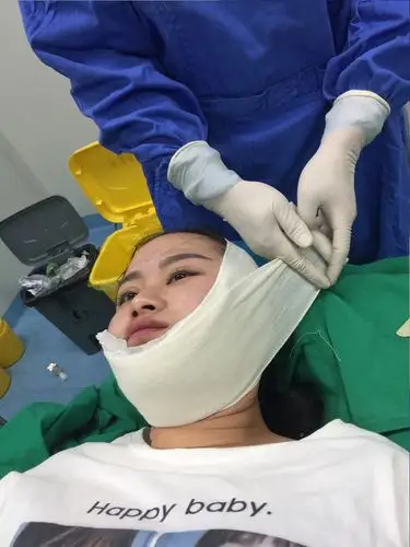 术后在下颌缘及面部包裹消毒纱布,再戴上塑型头套进行塑型作用,以便
