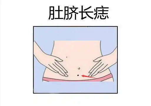 肚脐周围有痣拥有这样的痣的人,代表这个