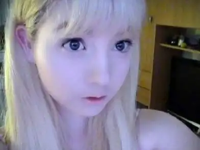 白化病人能活多久