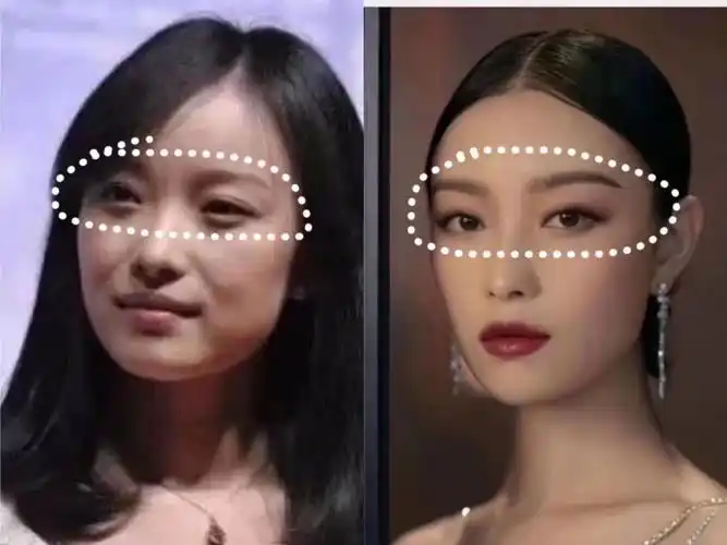 明星级别的抗衰老部位_抗衰老_龙湖·春江彼岸自由行热门攻略_我的变