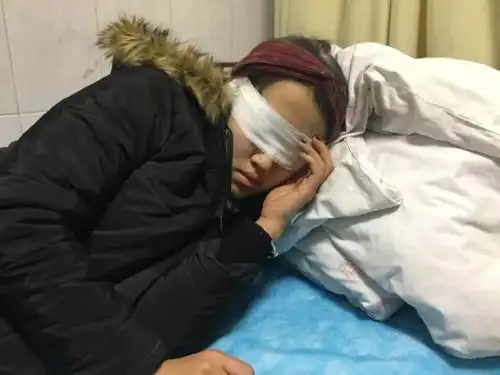 酒店前台女子正值班却被突然进来的男子用灭火器喷全身肺部眼睛多处