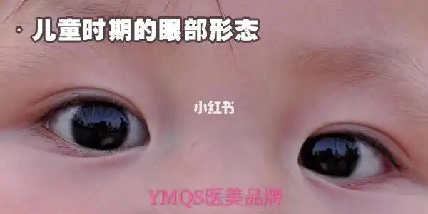 有些内眦赘皮的眼睛为什么更显"嫩"?