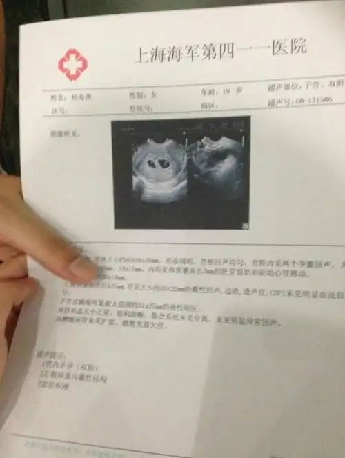 胎 女孩      [提要]发觉自己未婚先孕,竟然在网络上晒出验孕棒及b超