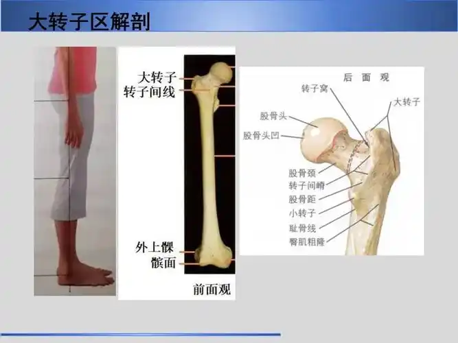 【每周一讲】股骨大转子疼痛综合征mr特征