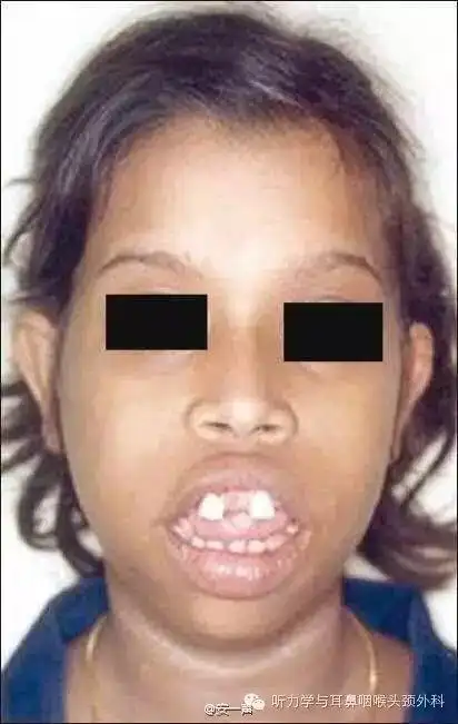 图片吓死人! - 好大夫在线