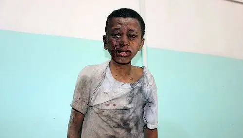 也门校巴司机买水工夫孩子们就被炸 联合国:真的够了!