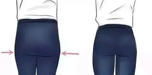 假胯宽:假胯宽的位置则是在大腿根,股骨头位置突出,(又称大转子突出).