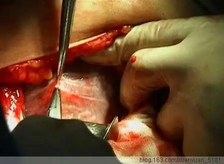 引用 向伟大的母亲致敬——女人分娩全过程 - 红尘过客 - 红尘过客的