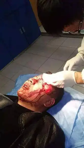 小伙劝架陌生夫妻 被围观者当成"小三"打得满脸血