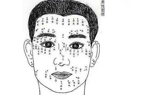 女人颈部有痣图解大全