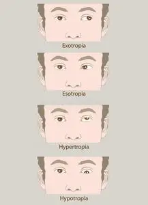 斜视眼滑稽图片