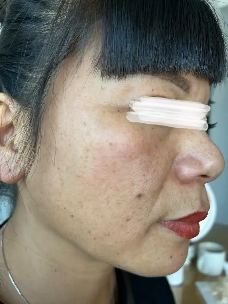 斑到底能不能去掉?相信术业有专攻,尊重皮肤生理结构,分享自己 - 抖音