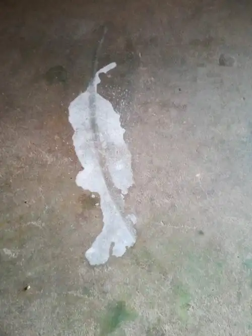 我想问一下,我女儿尿完干了之后,是白色的痕迹