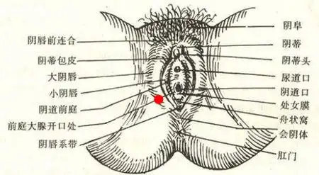阴道外侧长了一粒肉,请问是什么病?