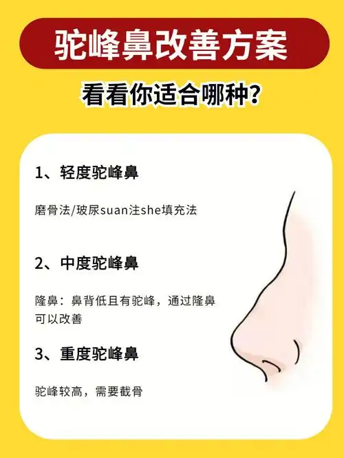 驼峰鼻四大改善方案6073