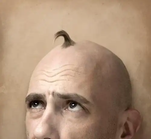 秦昊变秃头大叔男士脱发自救指南要get