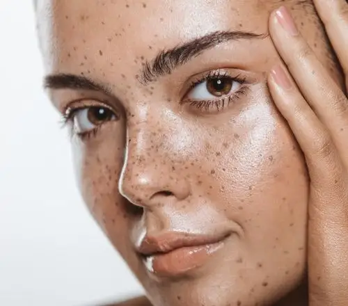 雀斑图片素材_图片id:313205671