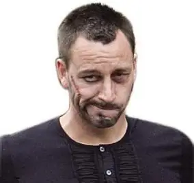 脸上带有伤疤的头像 头像图片大全 -【爱个性】