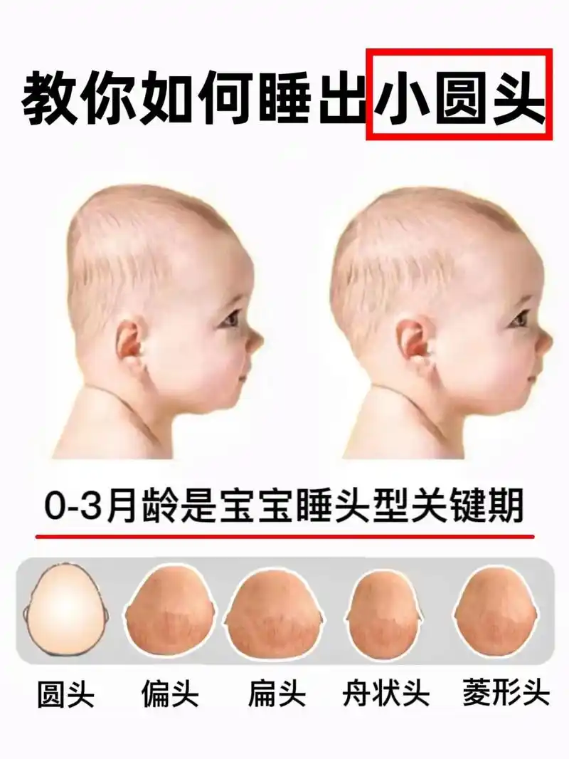 终于有人把宝宝睡圆头说清楚了6015 一,睡头型关键期 宝宝睡头