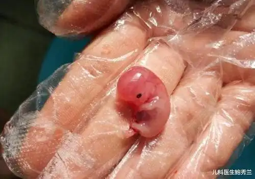 仅60天孕周的胎儿,药流后完整引出的样子看哭网友:真的太揪心了-爱子