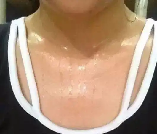 女性这几个部位出汗很危险!99%的人都还不知道!
