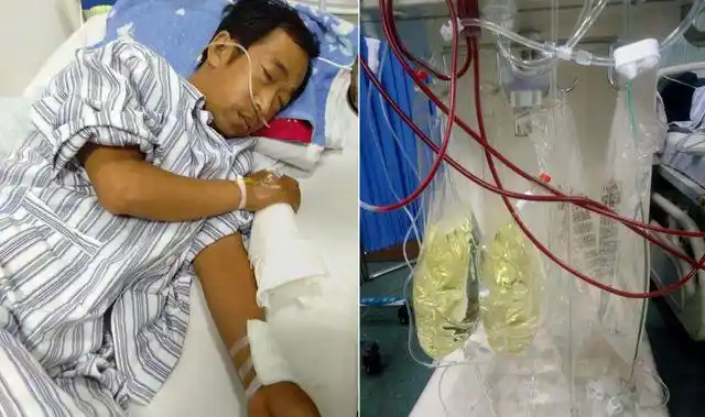 35岁男子患尿毒症依靠透析活命后悔年轻时太无知不懂节制
