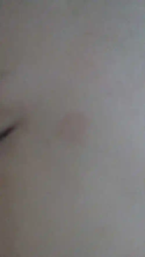 宝宝皮肤上长了汗斑,俗称 癣大家知道擦什么药膏好吗?