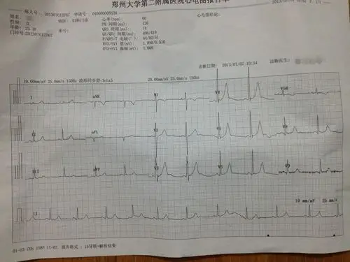 帮看下心电图有问题没!
