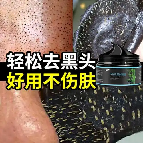skt竹炭去黑头面膜120g撕拉式去吸黑头粉刺鼻贴膜男女黑头导出液采购