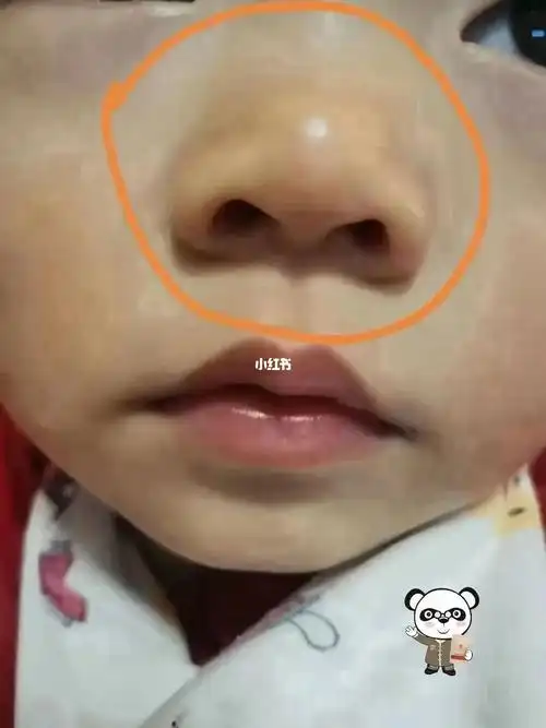 黄鼻头面色黄手脚黄的小朋友看过来