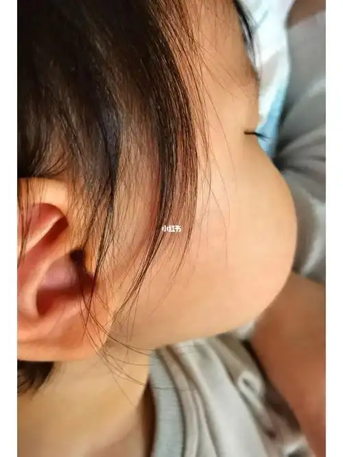 终于拍到了小新同款侧脸