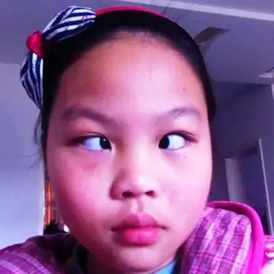 斗鸡眼图片 (16)