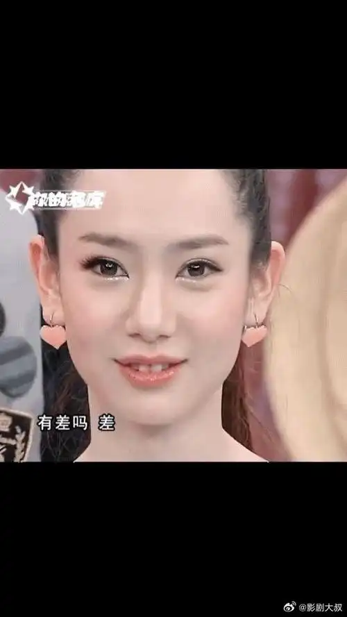早期的戚薇留着两颗小兔牙,纯情得如一只小白兔.