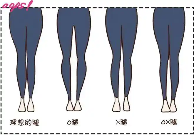 我惊呆了!|腿型|o型腿|筷子腿|大长腿_网易订阅