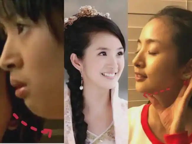 对比林依晨出道和现在的照片,她原本下巴后缩的弧度还挺严重,还伴随