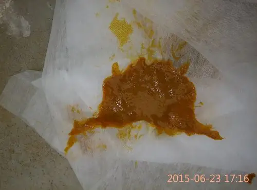 这是开赛露排出来的大便白色的可能是荧光粉请问这是便秘的颜色吗